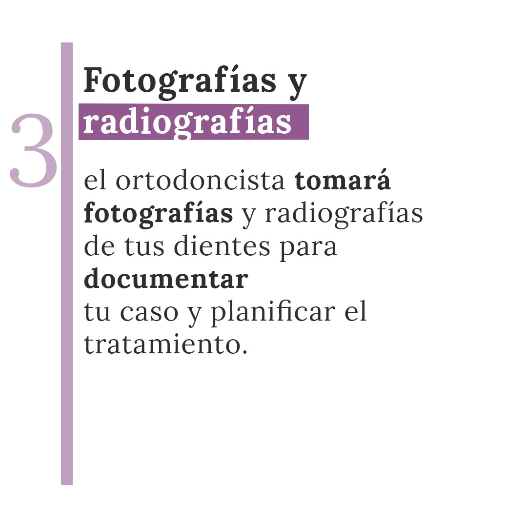 ORTODONCIA MASSIDENT JIJMesa de trabajo 3