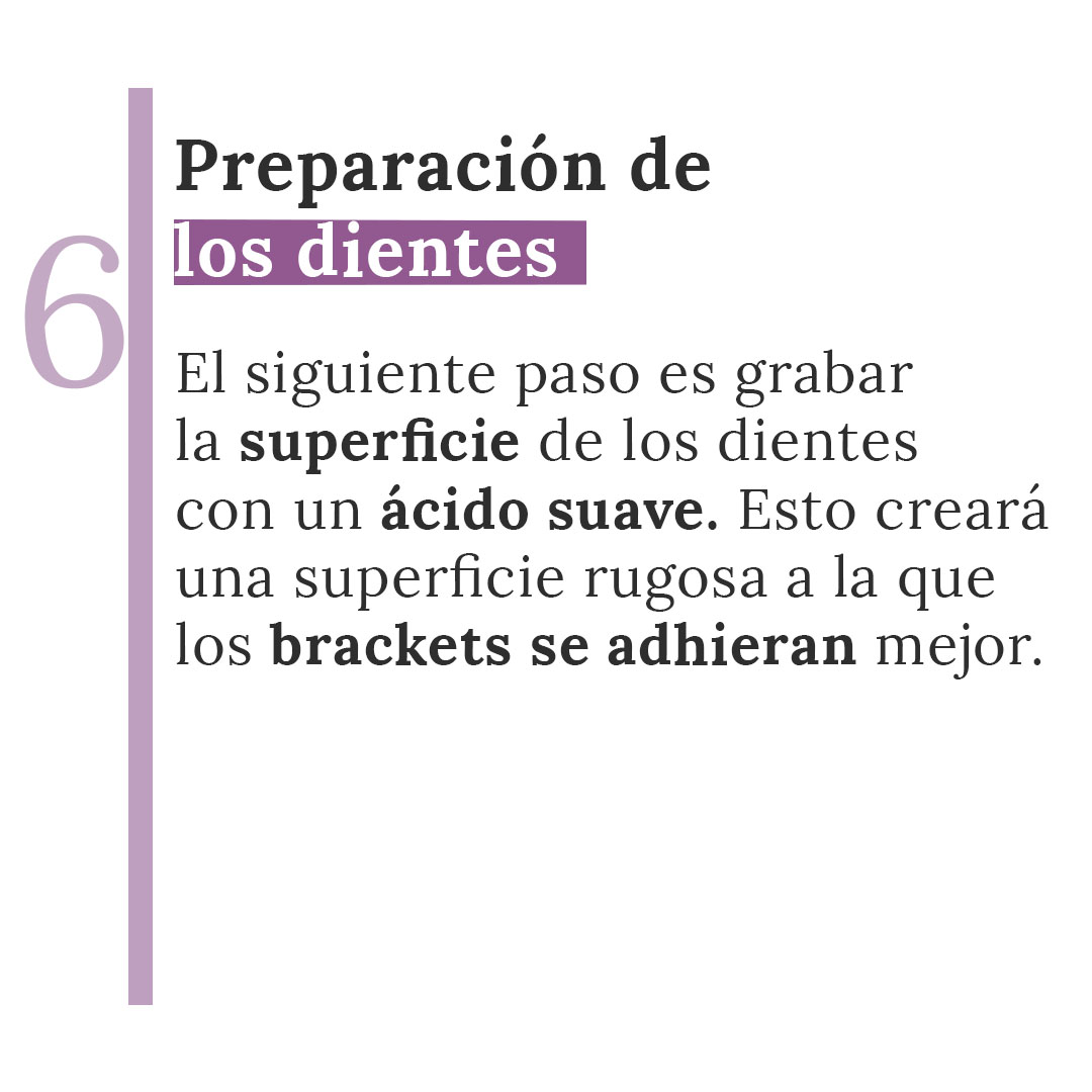 brackes Mesa de trabajo 6
