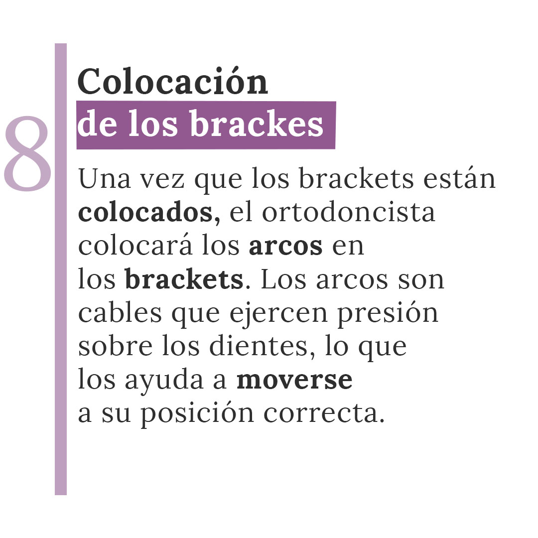 brackes Mesa de trabajo 8