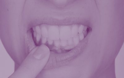 Soluciones para las encías retraídas
