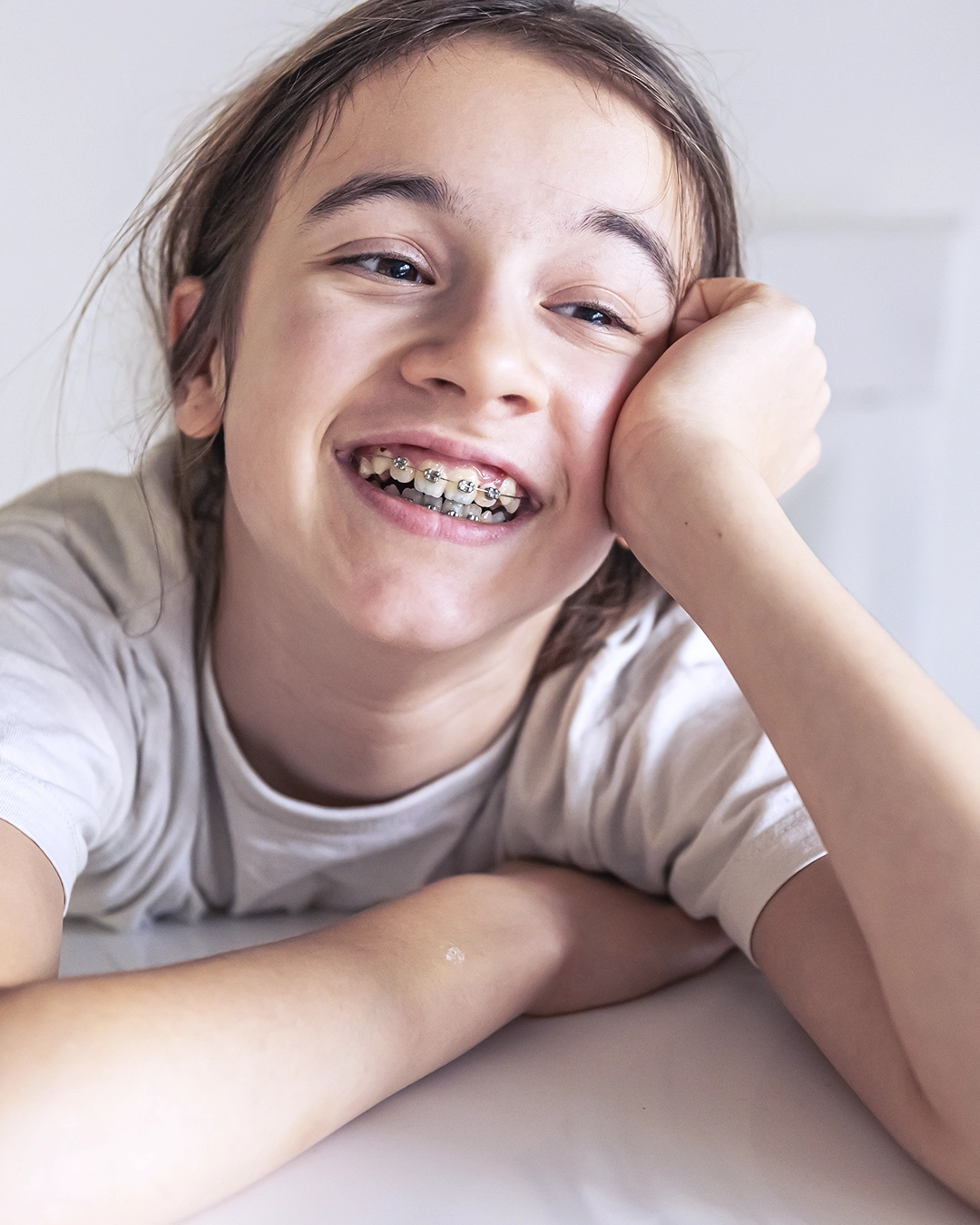 NIÑA2 Ortodoncia infantil