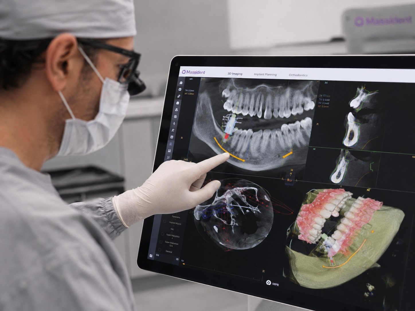 cirujano mirando planificando con tac dental caso de implantes dentales
